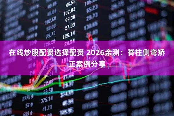 在线炒股配资选择配资 2026亲测：脊柱侧弯矫正案例分享